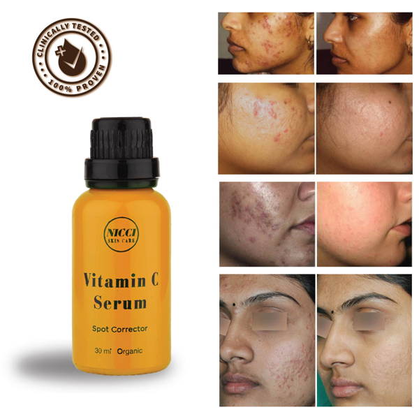 Nicci Spot Corrector Vitamin C Serum Nicci Skin Care
