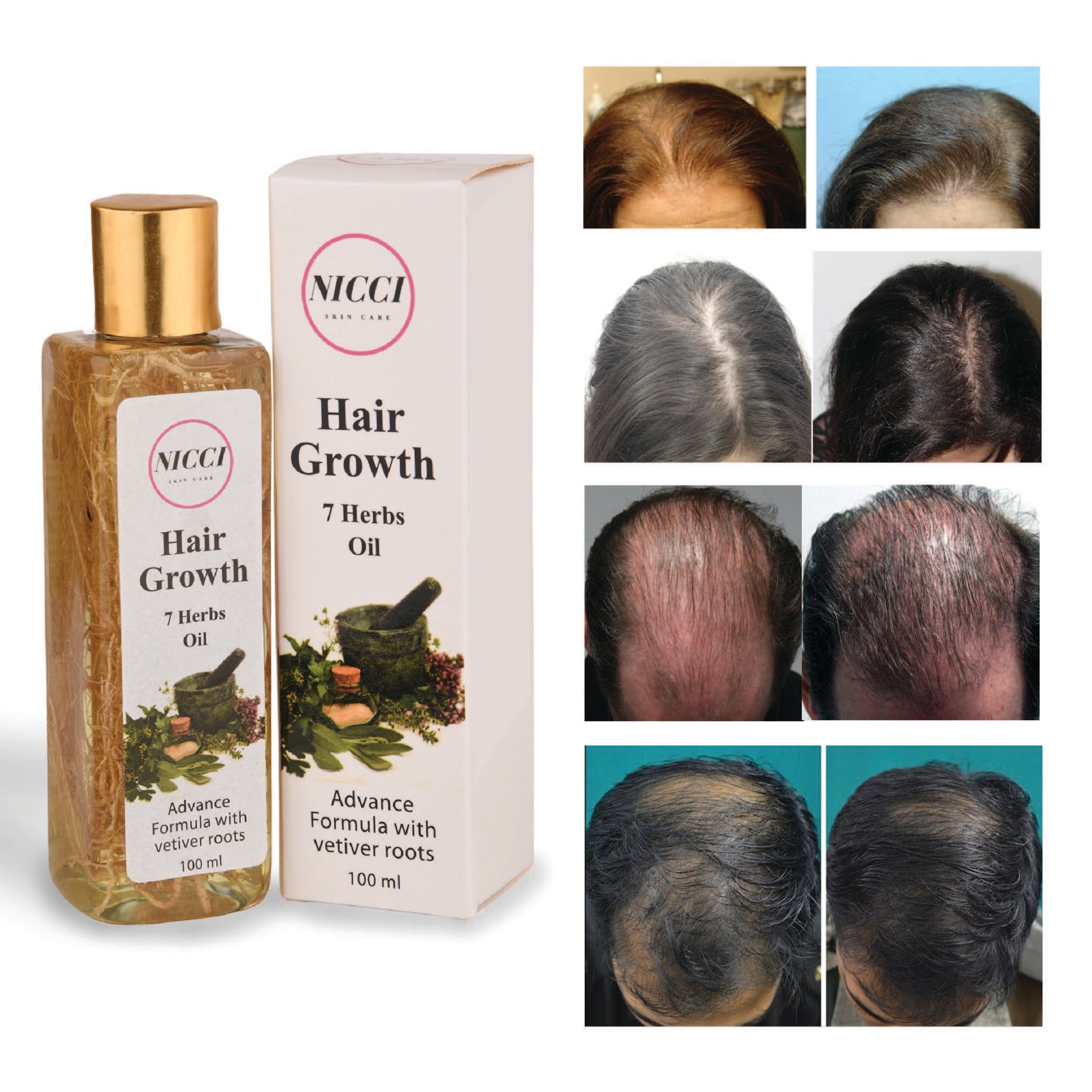 Seven Herbal Hair Oil , Silky, Smooth & Shiny Hair