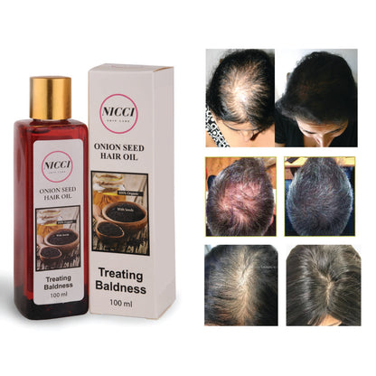 Onion Seed Hair Oil Nicci Skin Care