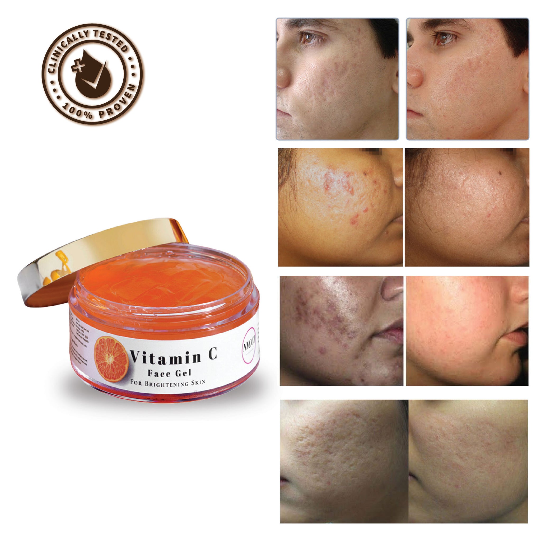 Vitamin C Face Gel Face Lightening Cream For Dull Skin Online Nicci